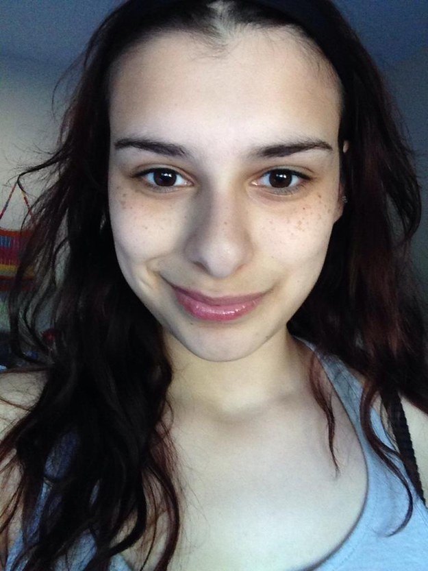 Then understand what causes bags under the eyes.